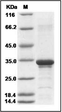 Human Beta-amyloid 38 / Beta-APP38 Protein (aa 672-709, His & GST Tag) SDS-PAGE