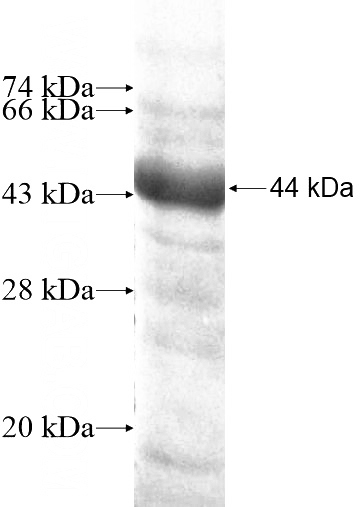 Recombinant Human UTP3 SDS-PAGE