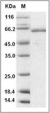 Mouse TLR2 Protein (His Tag) SDS-PAGE
