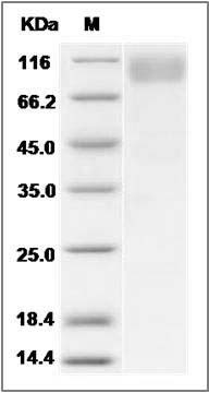 Human PDGFRB / PDGFR-1 / CD140b Protein SDS-PAGE