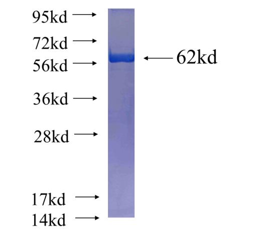 Recombinant human ATP1A1 SDS-PAGE