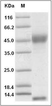 Rat FCGRT & B2M Heterodimer Protein SDS-PAGE