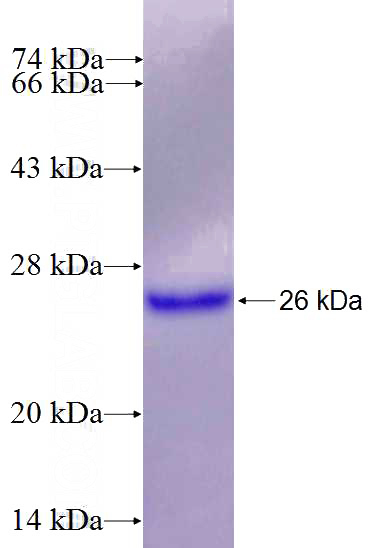 Recombinant Human HOXA5 SDS-PAGE