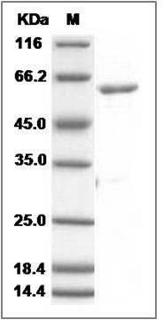 Human ROR1 Protein (aa 453-783, His & GST Tag) SDS-PAGE