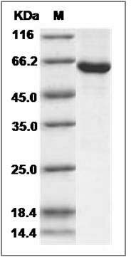 Human SPHK1 / Sphingosine Kinase 1 Protein (His & GST Tag) SDS-PAGE