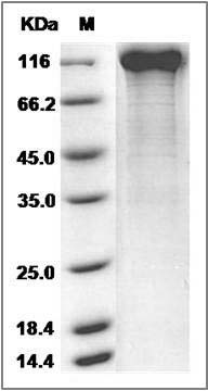 Cynomolgus CD22 Protein (Fc Tag) SDS-PAGE