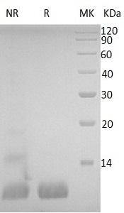 Human IGF1/IBP1 recombinant protein