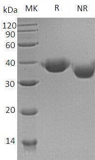 Human JAM2/C21orf43/VEJAM/UNQ219/PRO245 (His tag) recombinant protein