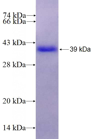 Recombinant Human PYGL SDS-PAGE