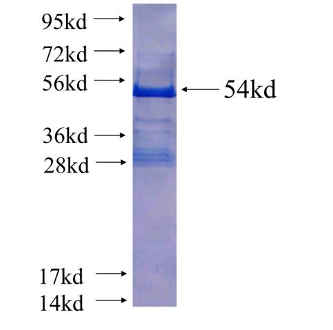 Recombinant human TSSC4(Full length) SDS-PAGE