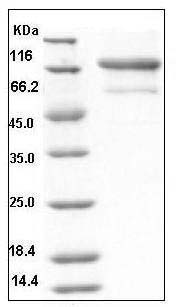 Human TNFR2 / CD120b / TNFRSF1B Protein (His & Fc Tag) SDS-PAGE