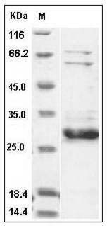 Human XIAP / BIRC4 Protein (AVI Tag) SDS-PAGE
