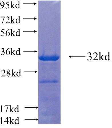Recombinant Human DNAJC9 SDS-PAGE