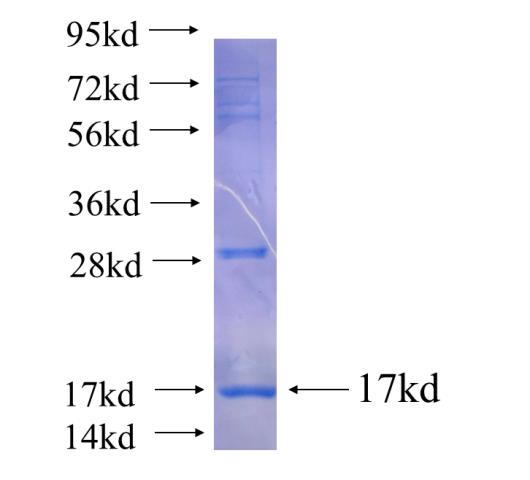 Recombinant human FAM78A SDS-PAGE