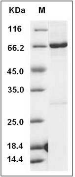 Human nemo-like kinase / NLK Protein (His & GST Tag) SDS-PAGE