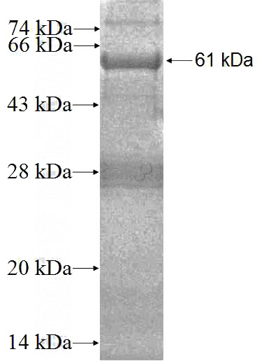 Recombinant Human A4GALT SDS-PAGE