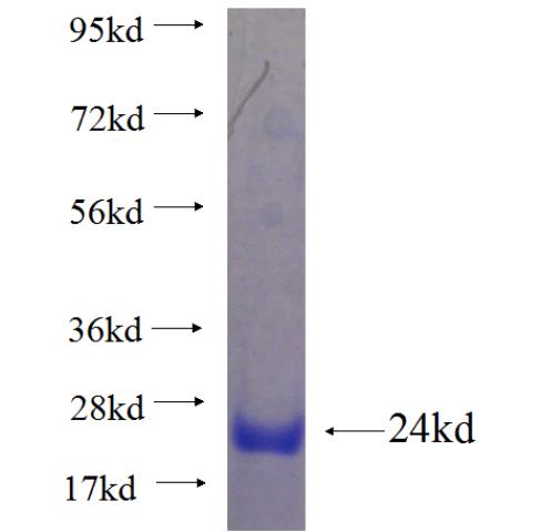 Recombinant human IL2 SDS-PAGE