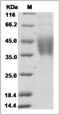 Mouse IL-21R / Il21R Protein (His Tag)