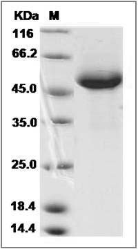 Human RAB27B Protein (Fc Tag) SDS-PAGE