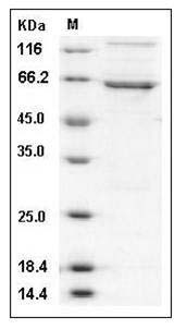 Human DAPK1 / DAP Kinase 1 Protein (aa 1-363, His & GST Tag) SDS-PAGE