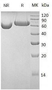 Human LAG3/FDC (His tag) recombinant protein