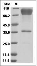 Ebola virus EBOV (subtype Zaire, strain H.sapiens-wt/GIN/2014/Kissidougou-C15) Glycoprotein / GP-RBD Protein (Fc Tag)