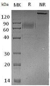 Mouse Tyro3/Dtk/Rse/Tif (mFc tag) recombinant protein