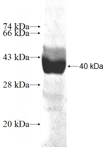 Recombinant Human LRRC8A SDS-PAGE