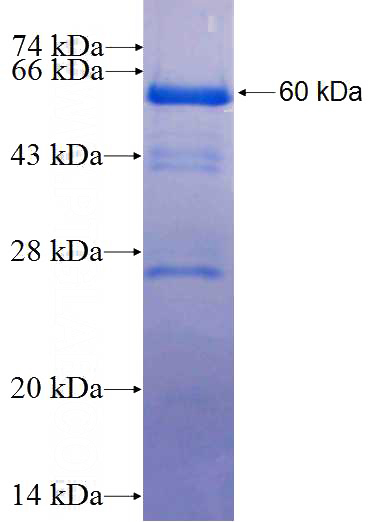 Recombinant Human EEF2K SDS-PAGE