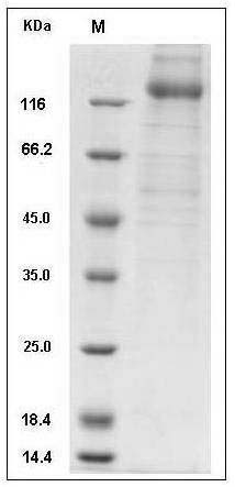 CMV Glycoprotein B / gB Protein (His Tag) SDS-PAGE