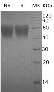 Human ICOSLG/B7H2/B7RP1/ICOSL/KIAA0653 (His tag) recombinant protein