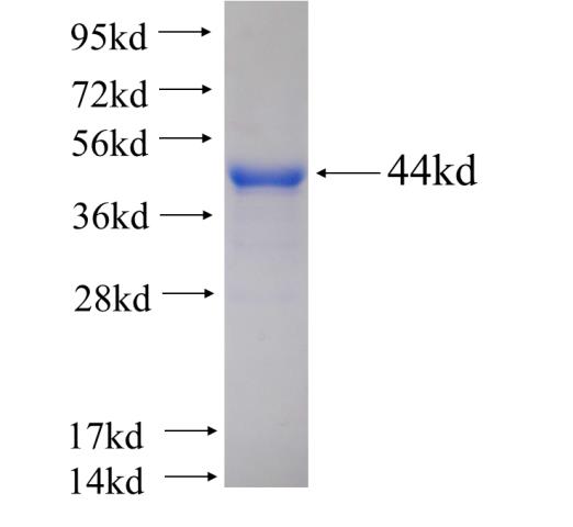 Recombinant Arabidopsis thaliana DHDPS2 SDS-PAGE
