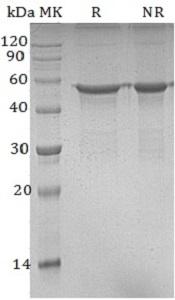 Human POLD2 (His tag) recombinant protein