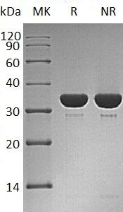 Human PTPN6/HCP/PTP1C (His tag) recombinant protein