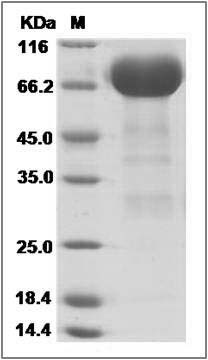 Rat EphA3 Protein (His Tag) SDS-PAGE
