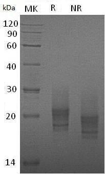 Mouse Csf2/Csfgm (His tag) recombinant protein