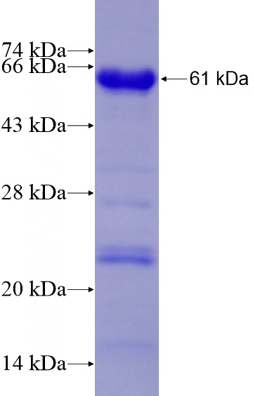 Recombinant Human SP100 SDS-PAGE