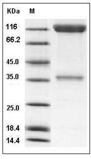 Human PDGFRB / CD140b Protein (His & Fc Tag) SDS-PAGE