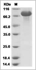 Serpina1b protein SDS-PAGE