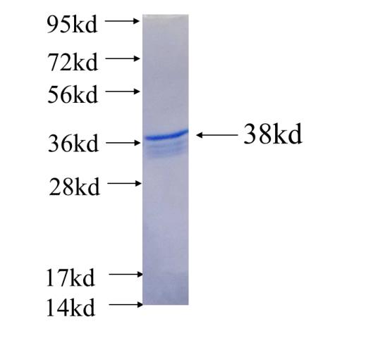 Recombinant human C1orf104 SDS-PAGE