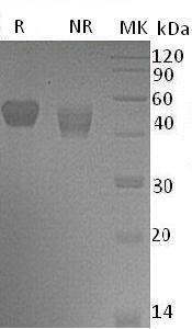 Mouse Cd5/Ly-1 (His tag) recombinant protein