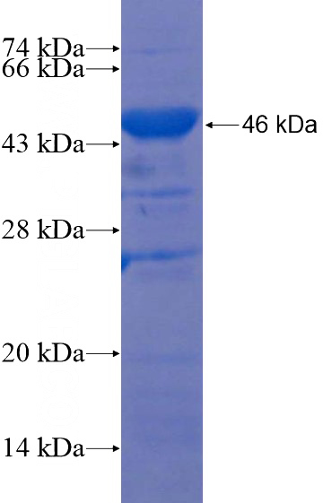 Recombinant Human SYNPO2 SDS-PAGE