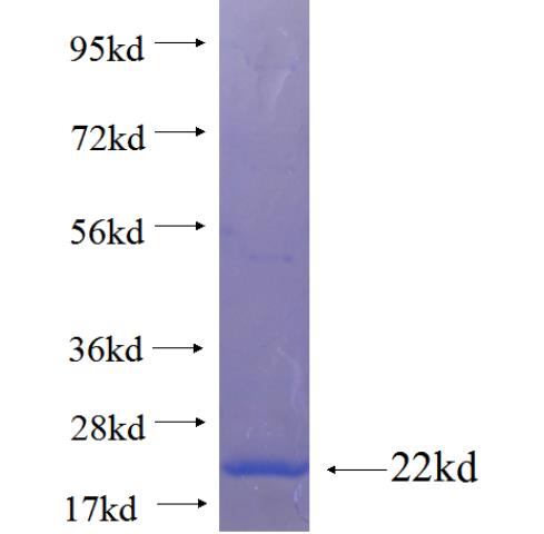 Recombinant human C14orf119 SDS-PAGE