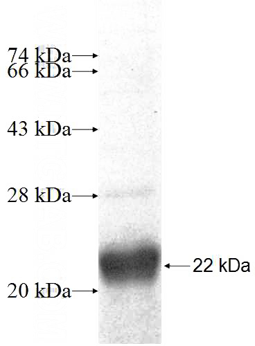 Recombinant Human ATP13A1 SDS-PAGE
