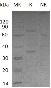 Mouse Vtcn1/B7h4 recombinant protein