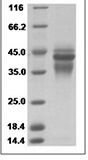 Human IL12/IL12A & IL12B Protein 15483