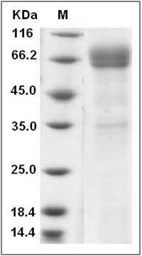 Human CD1B / CD1A Protein (Fc Tag) SDS-PAGE