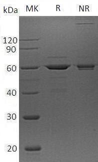 Human ZBTB9 (His tag) recombinant protein