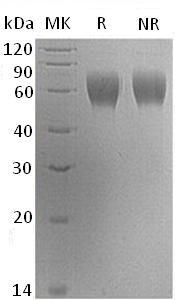 Human SERPINA6/CBG (His tag) recombinant protein