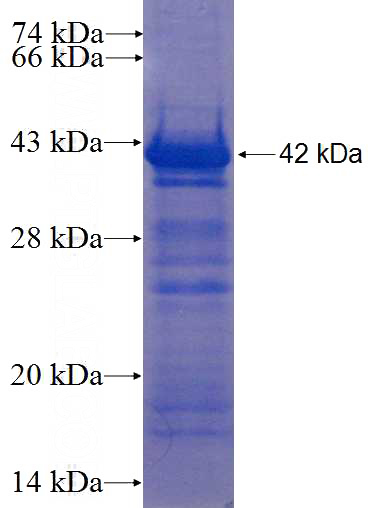 Recombinant Human OSBP SDS-PAGE